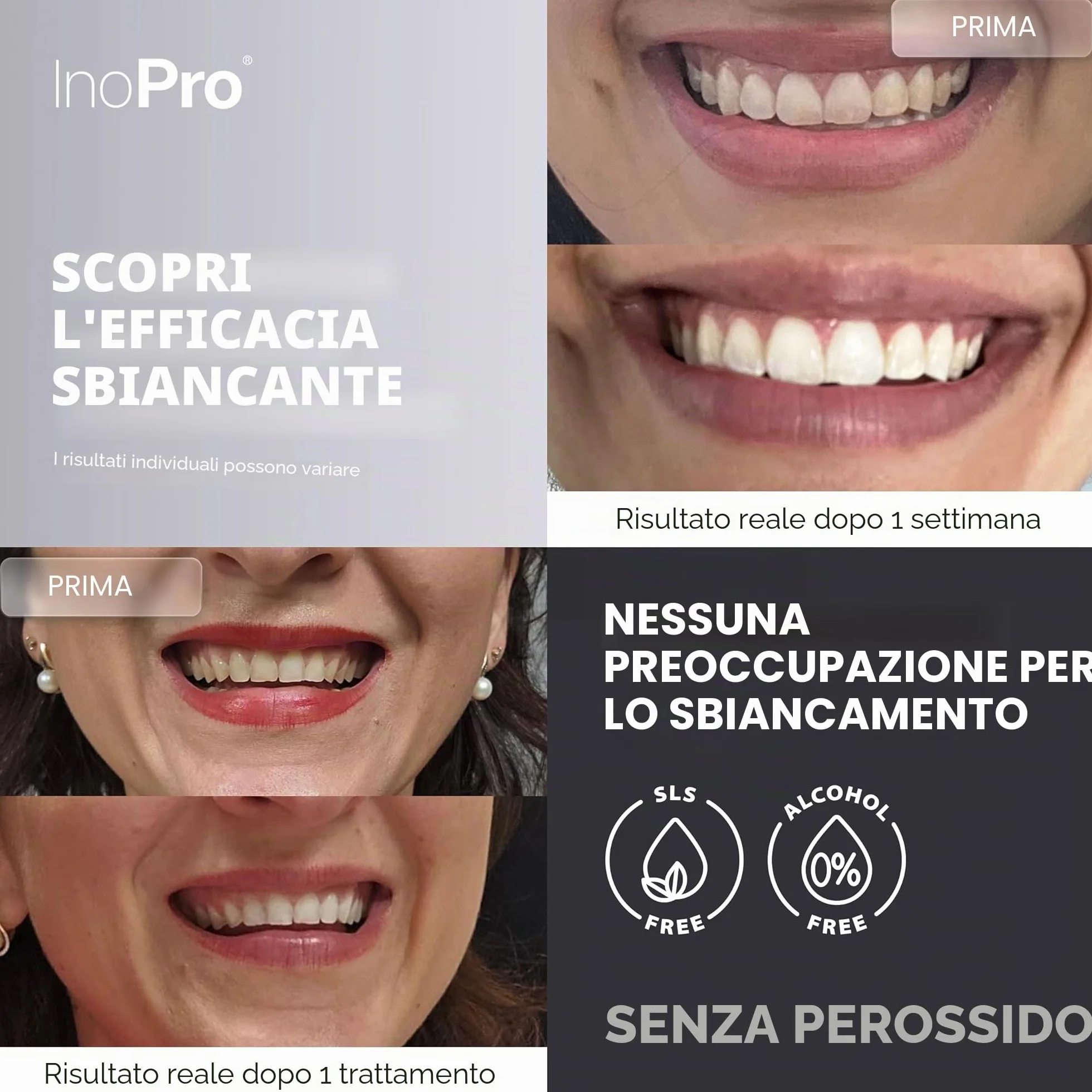 InoPro Kit strisce sbiancanti denti 14 trattamenti senza perossido smalto sicuro