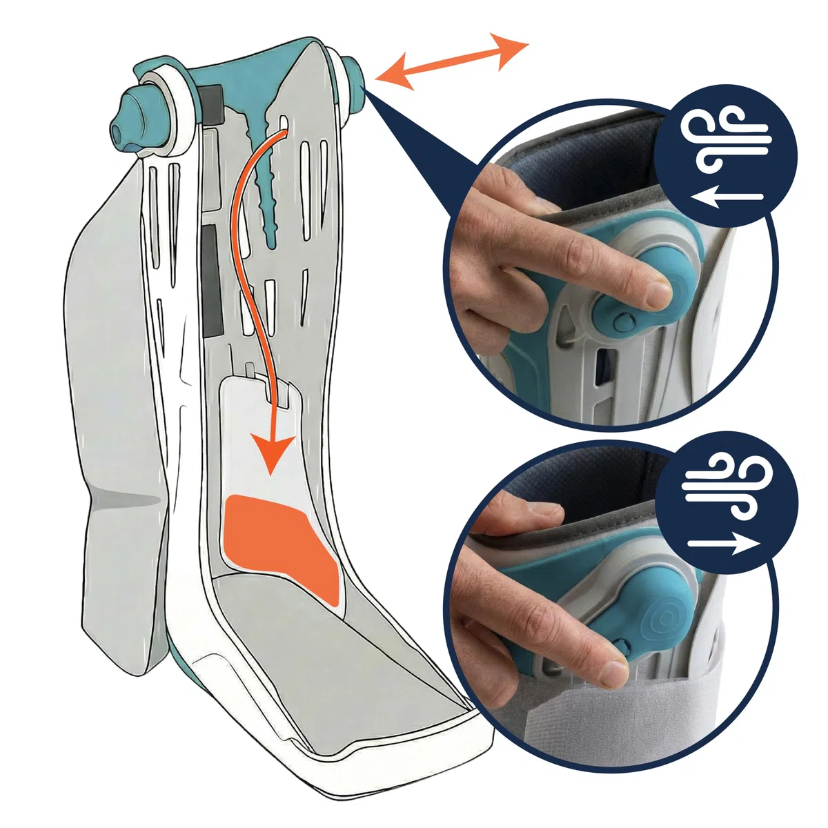 KMINA Tutore Walker Alto Gonfiabile S (Taglie 35,5 a 39,5), Stivale Ortopedico per Immobilizzazione di Piede e Caviglia, Regolazione Pneumatica con Valvola, Unisex Destro o Sinistro