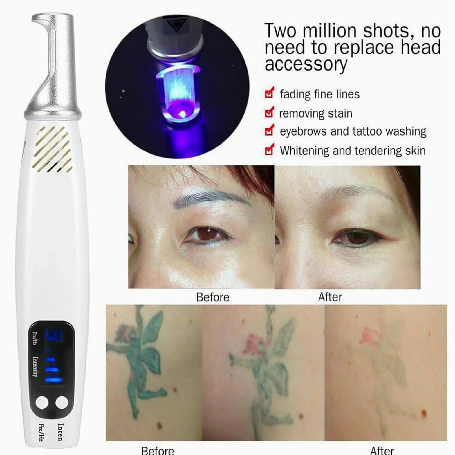 Penna Laser Picoseconda Dispositivo Bellezza Cura della Pelle con Luce Blu/Rossa, 9 Marce e 4 Livelli per Etichette Cutanee, Tatuaggi, Lentiggini, Pigmentazione, Cicatrici con Occhiali,Blu