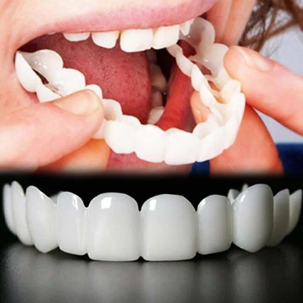 Protesi Dentarie Temporanee a Clip per Denti Mancanti Storti Macchiati